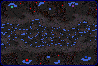 heartattackmap.gif (9479 octets)